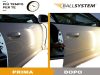 BallSystem®
